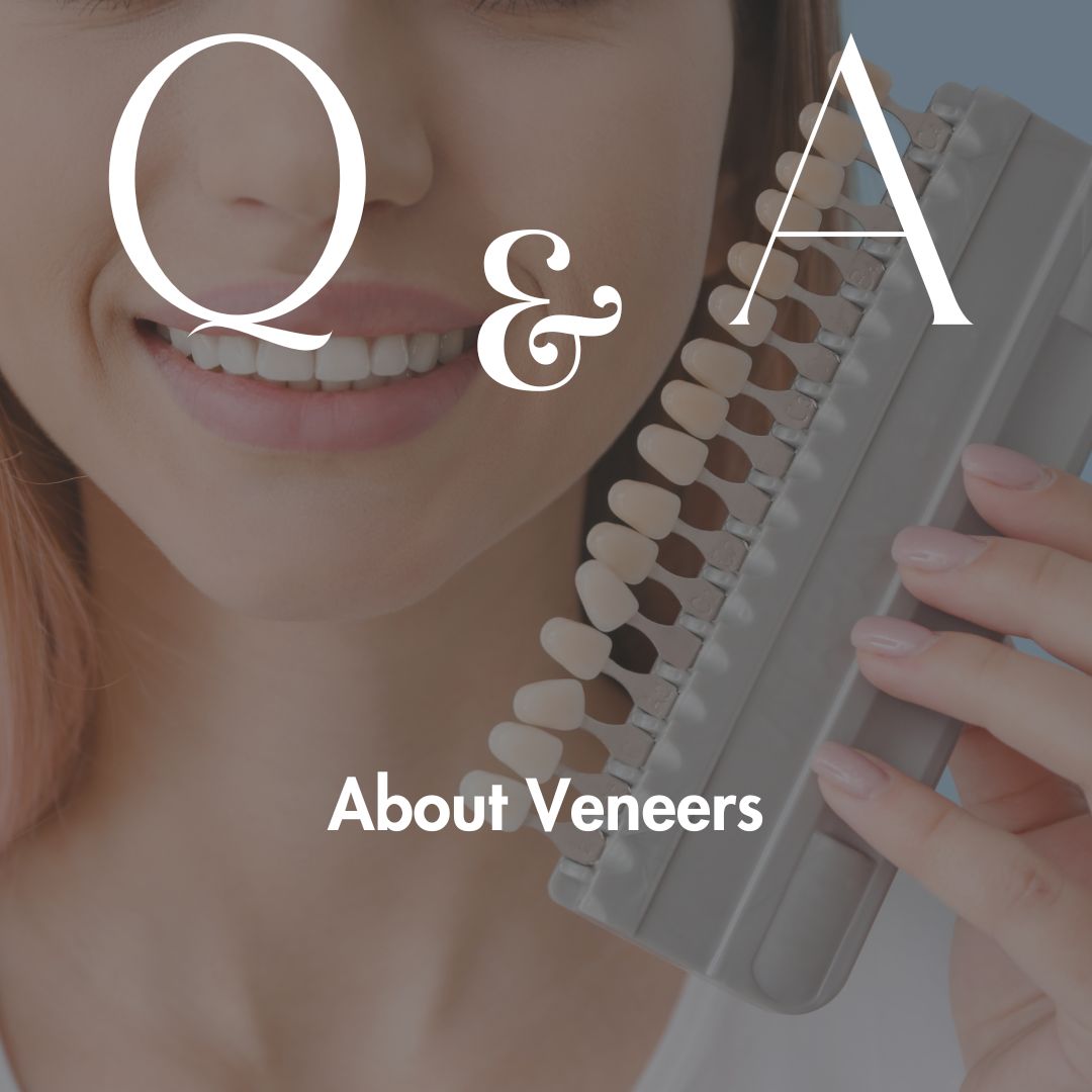 Q&A Veneers
