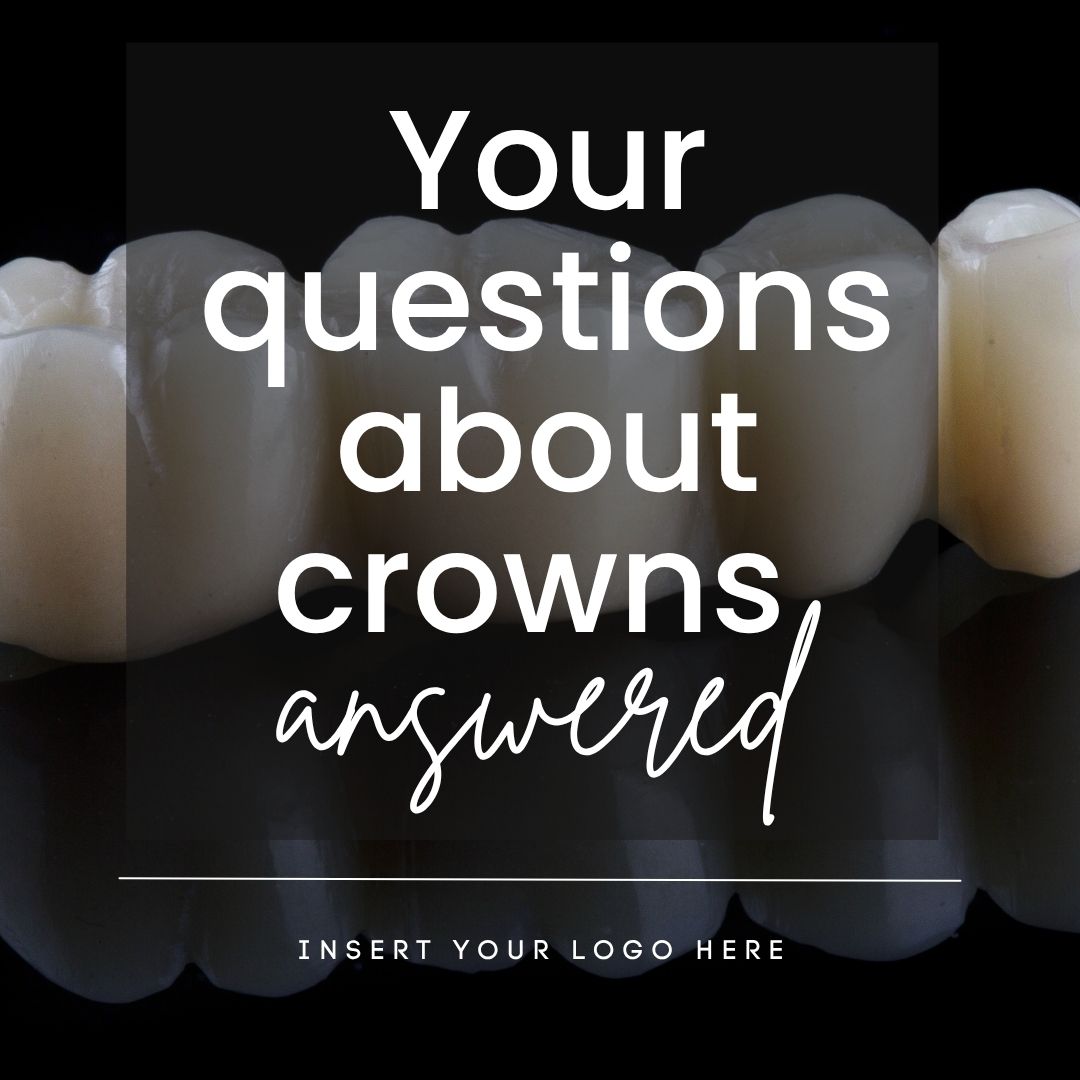Your questions about crowns answered