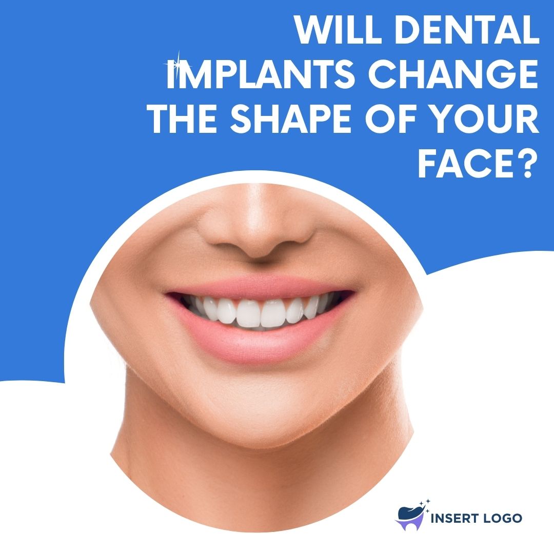 Will Dental Implants Change the Shape of Your Face?